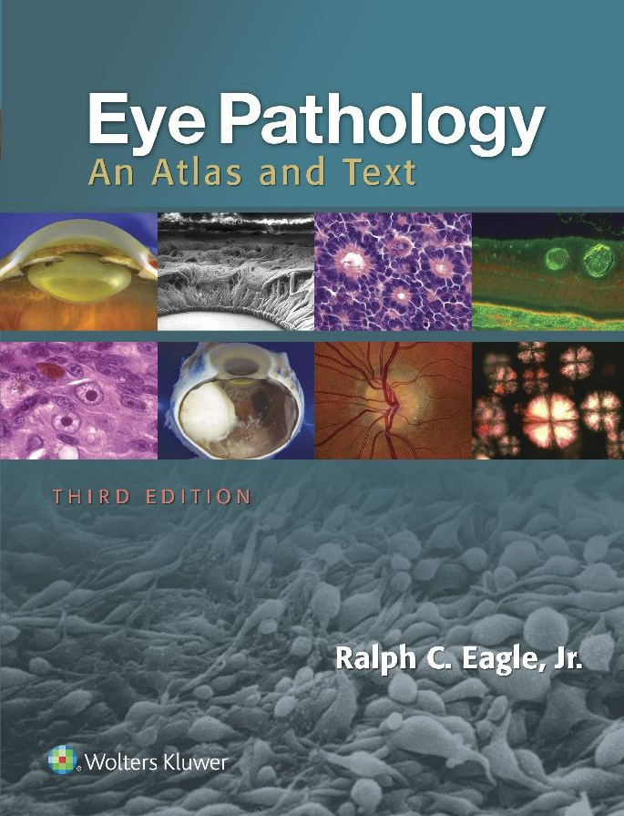 眼科病理:希少洋書専門書Ophthalmic Pathology Ophthalmic Pathology: A Concise Guide | SpringerLink